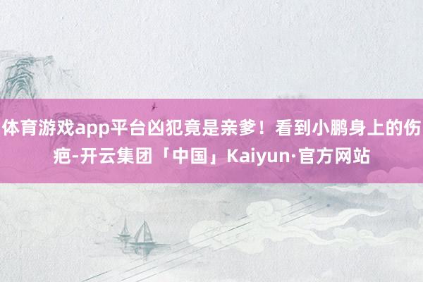 体育游戏app平台凶犯竟是亲爹！看到小鹏身上的伤疤-开云集团「中国」Kaiyun·官方网站